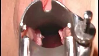 Onun için amdansikme kedi